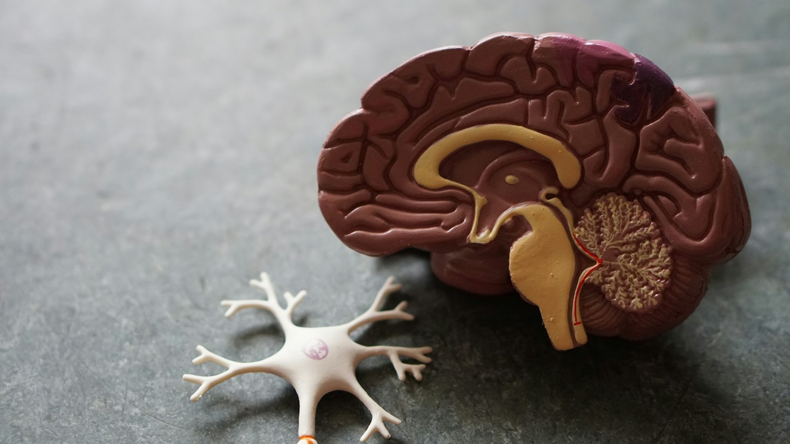 Anatomical brain model highlighting brain health for World Stroke Day awareness