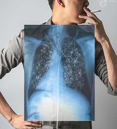Smokers Comprehensive package